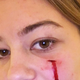 Image shows the scar Sunny left after her attack on the unidentified teen (Twitter)